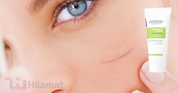 ترمیم پوست آسیب دیده با کرم ترمیم کننده گاتیو