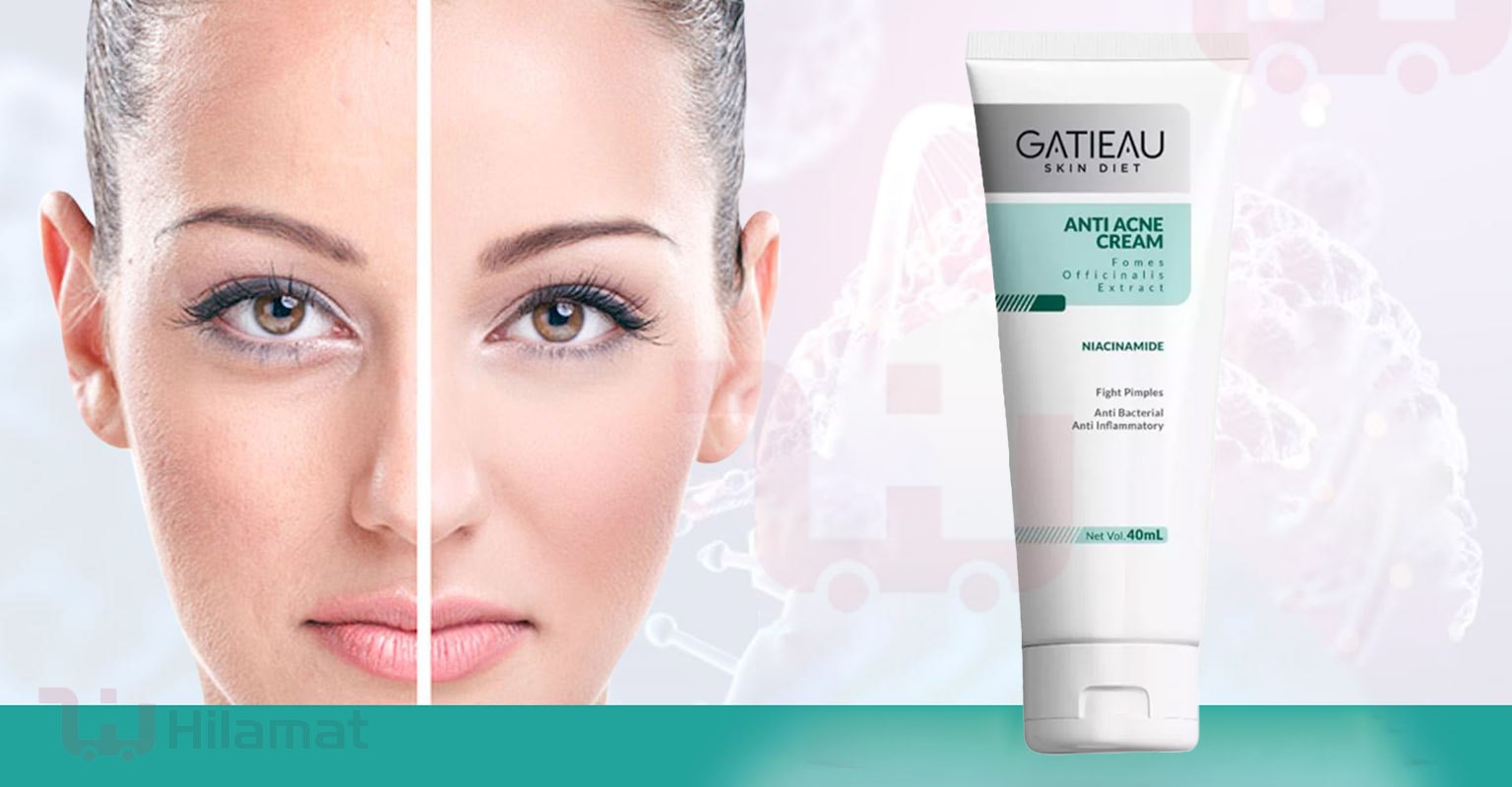 کرم آنتی آکنه و ضدجوش